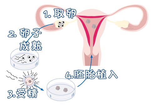 供卵代孕要多少费用